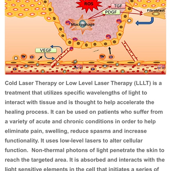 Sinoriko cool lazer red light - Picture 4 of 4